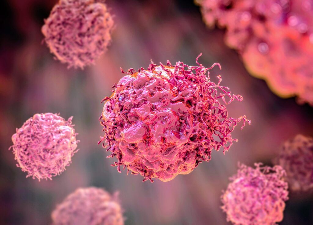 Cancer Specialist Urges Nigerians to Take Strange Symptoms Seriously